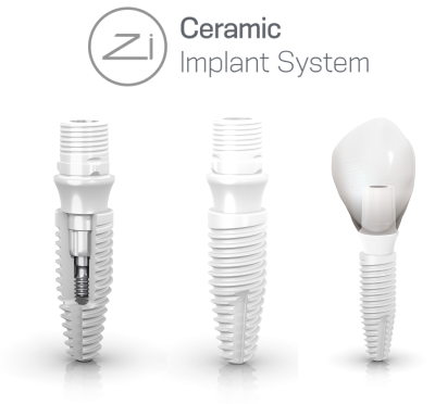 Implantes dentales cerámicos ceramicos