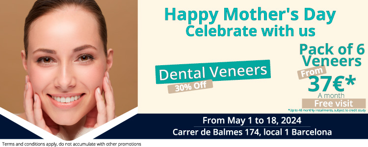 dental veneers CarrillasDent30porcientoOff-Barce-May24-movil2