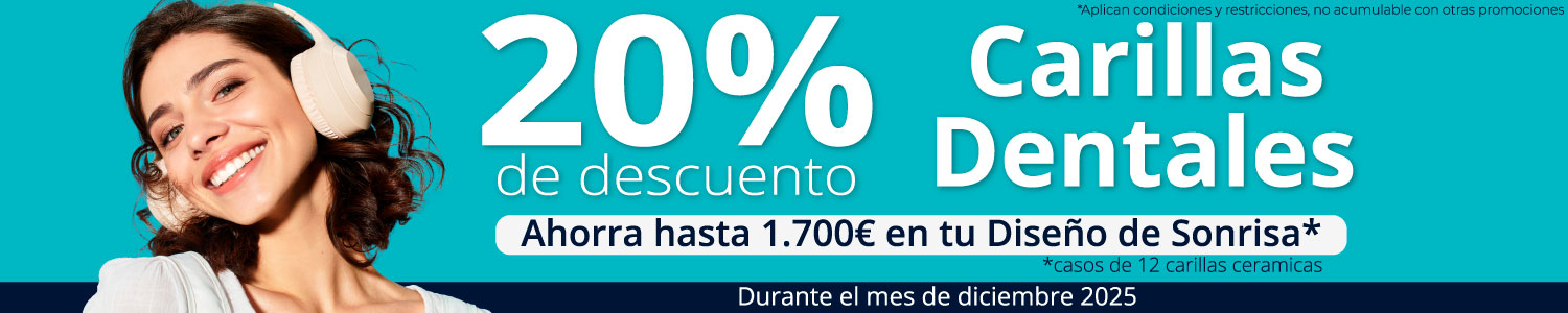 Diseño-20Off-Dici25-Espa-web carillas dentales