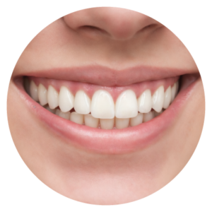 Smile Design