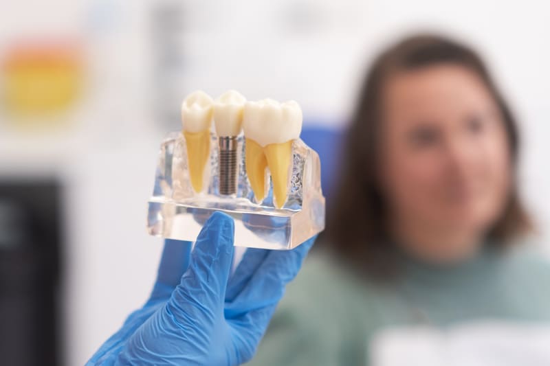 ¿Duele poner un implante dental? La respuesta honesta
