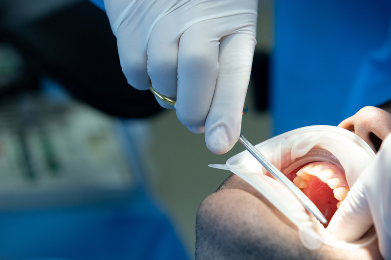 ¿Cuánto tiempo tarda en cicatrizar un implante dental?